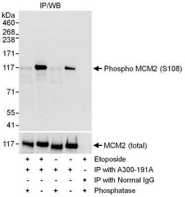 Western Blot: MCM2 [p Ser108] Antibody [NB100-639] - Samples: Whole cell lysate (1 mg for IP; 20% of IP loaded) from 293T cells either mock treated (-) or treated (+) with EPE (100 uM, 2h). Antibodies: MCM2 was immunoprecipitated using rabbit anti-MCM2 antibody was used for WB at 1 mcg/ml. To examine total MCM2, the blot was stripped and then blotted with rabbit anti-MCM2 antibody . Detection: Chemiluminescence with exposure times of 10 seconds (upper and lower panels).